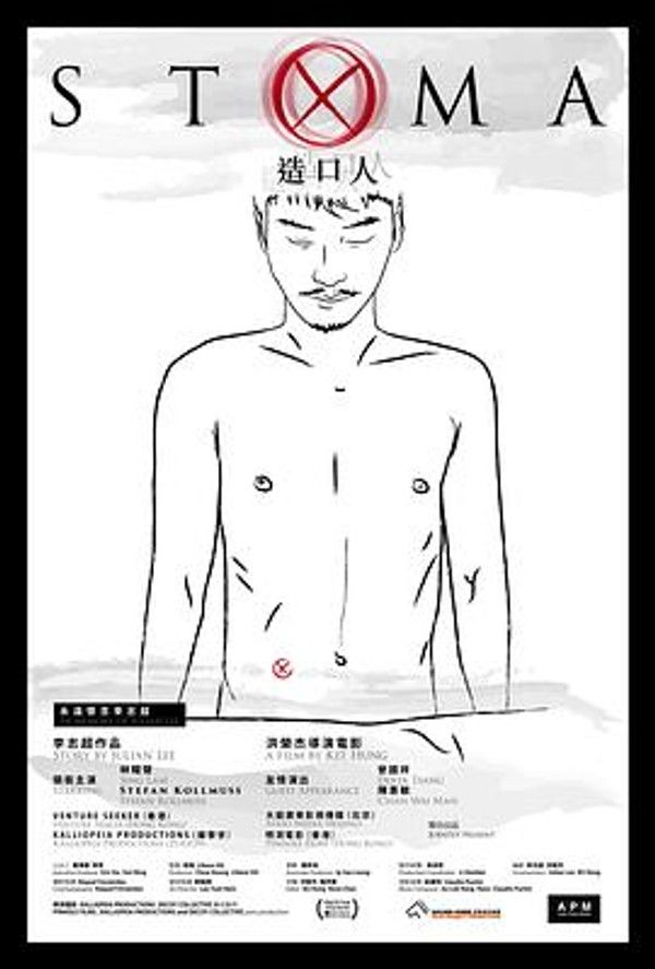 造口人
